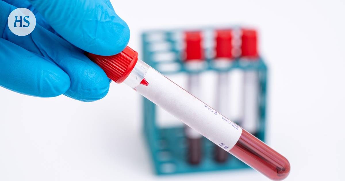 Alzheimer’s disease can soon be identified with a blood test