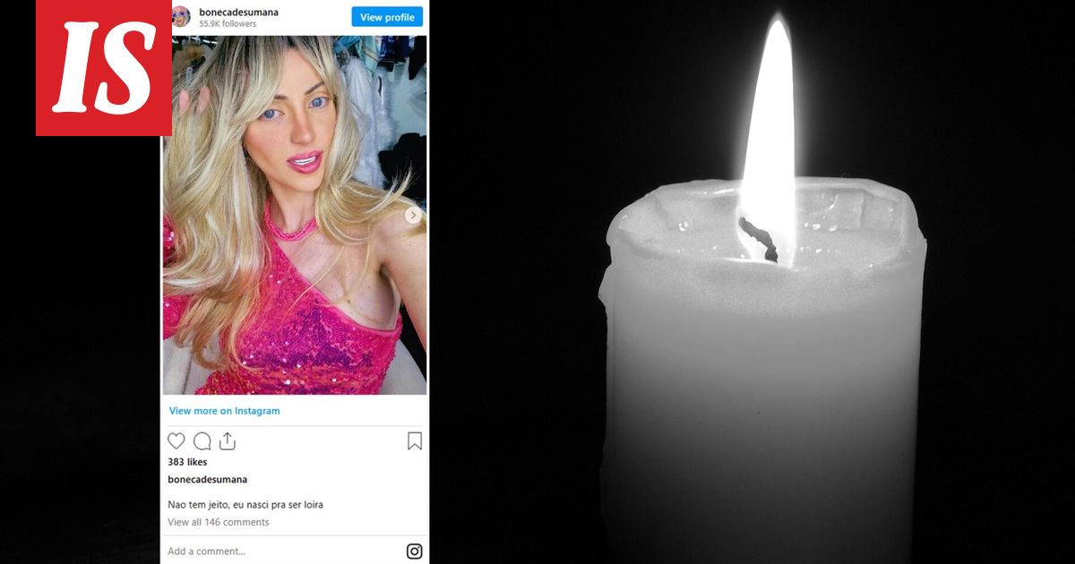 ”Ihmis-Barbie”, 31, on kuollut