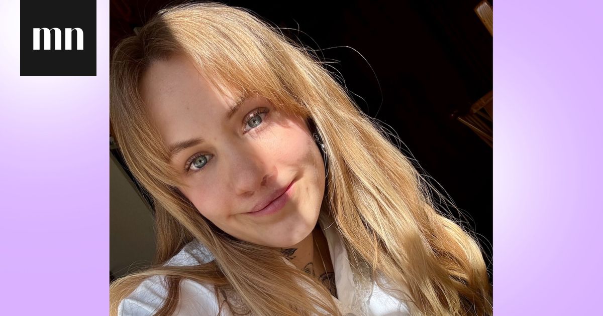 Kun Ida, 27, syntyi, hänen ulkonäkönsä oli monelle