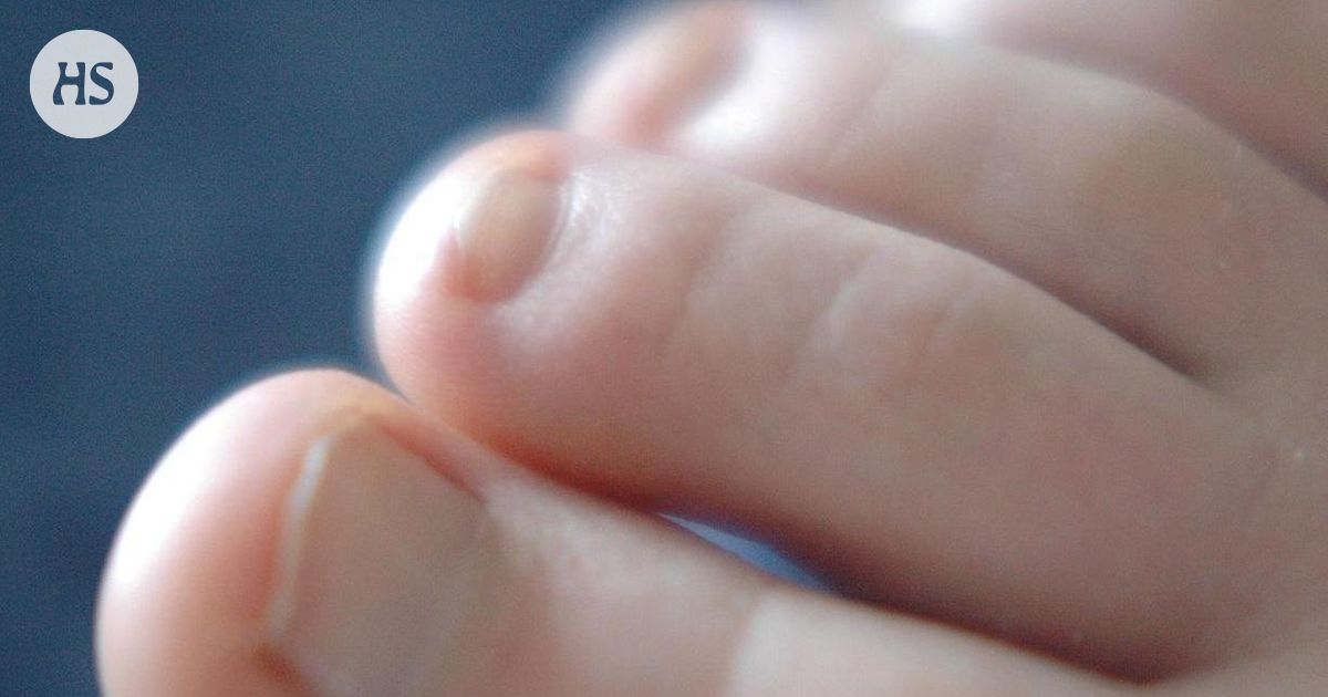 Lasten tiedekysymykset | Miksi sormen kynnet kasvavat nopeammin kuin varpaan?