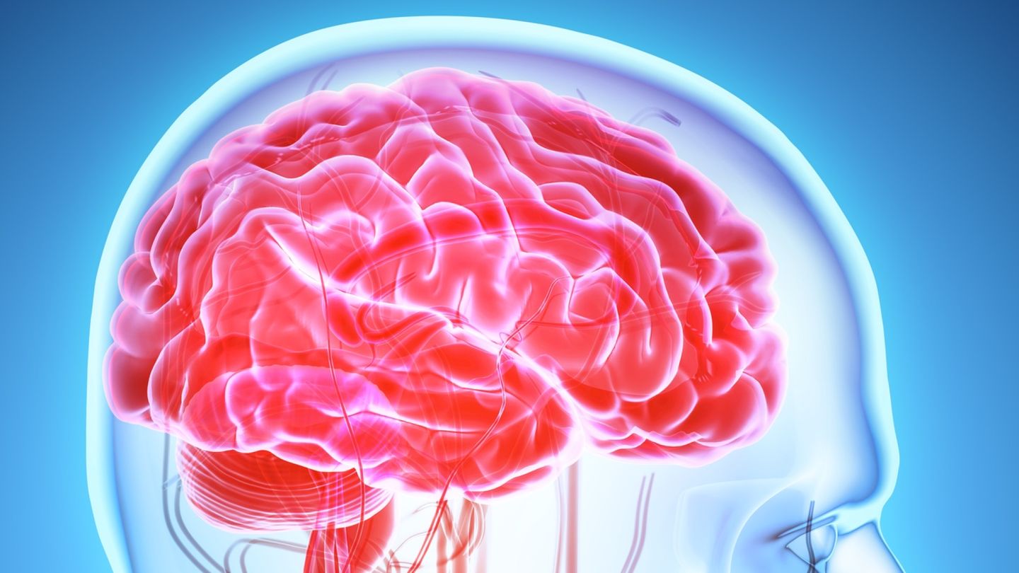 Tämä merkki voi enteillä Alzheimerin tautia – jopa vuosia ennen diagnoosia