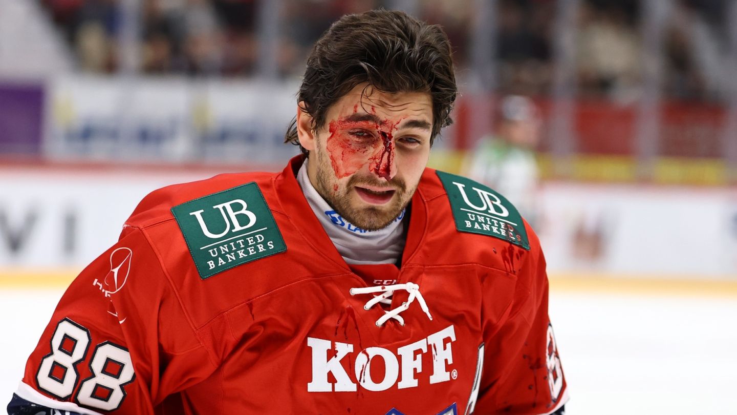HIFK:n Niko Huuhtanen sivussa viikkoja