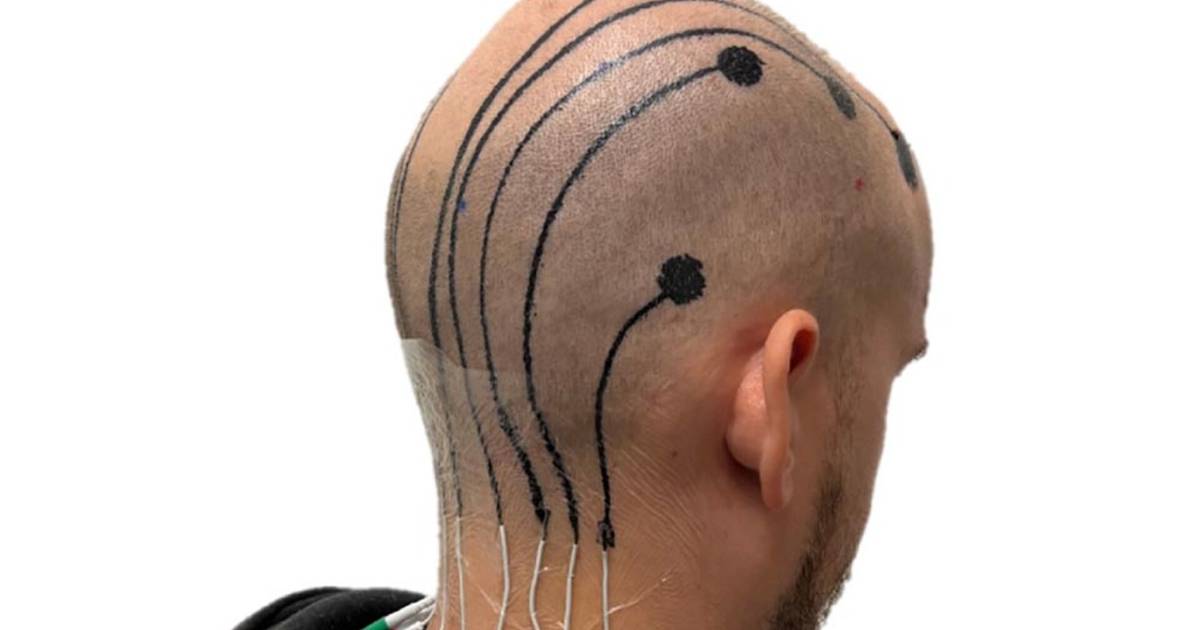 Tracking brain waves becomes easier thanks to e-tattoo ink