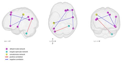 The brain regions connect to each other in varying ways, the study revealed.