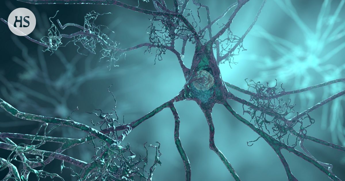 Lithium protects against Alzheimer’s disease – Could act as a medicine