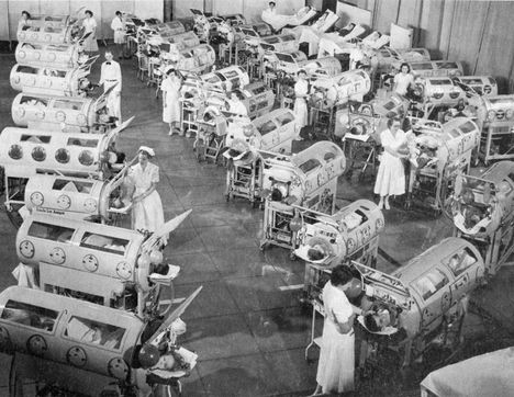Poliopotilaita autettiin hengittämään rautakeuhkoksi kutsutuissa laitteissa Yhdysvalloissa 1950-luvun suuren epidemian aikana.
